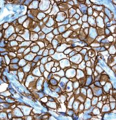 Ventana announces HER2 companion diagnostic to identify breast cancer patients for Roche's latest targeted medicines, Perjeta and Kadcyla